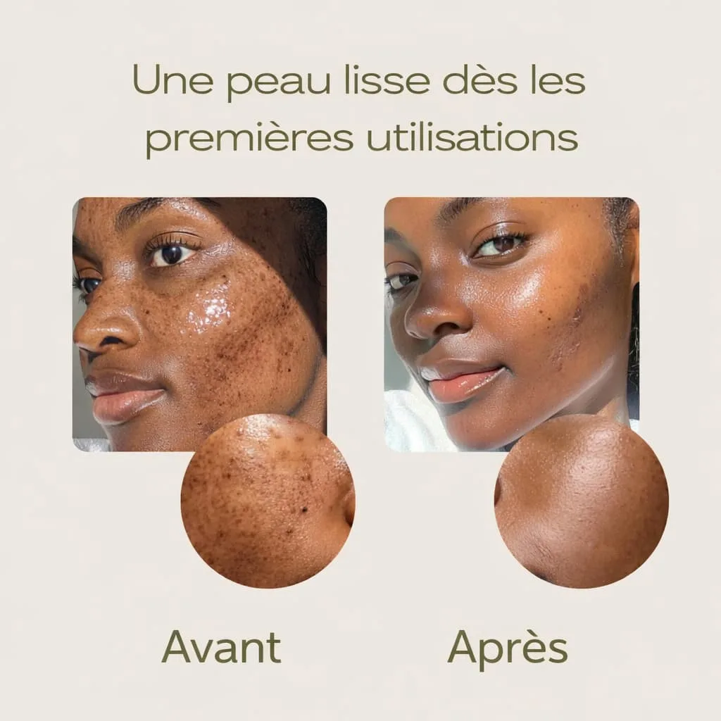 Peel Shot au Riz – Retrouvez une Peau Lisse, Nette et Lumineuse 3